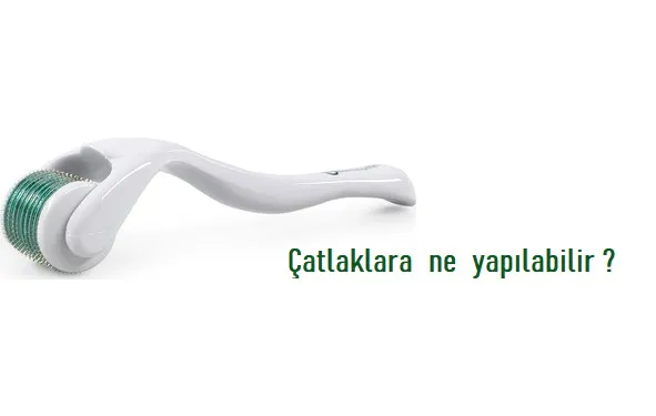 Çatlaklar Neden Oluşur